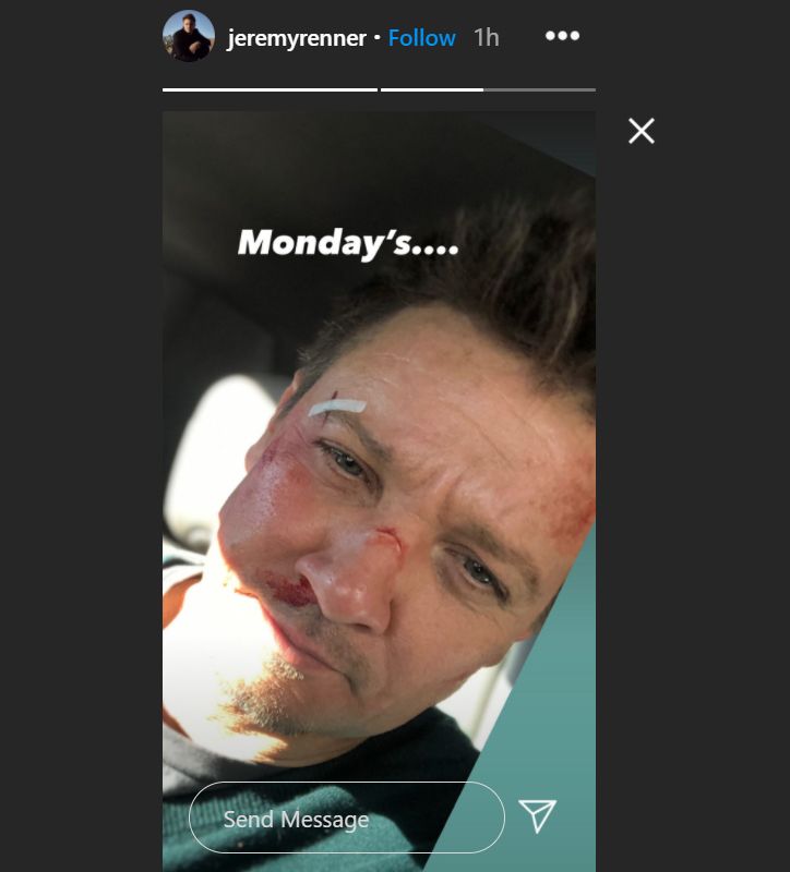 Hawkeye