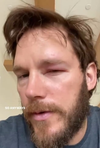 Chris Pratt